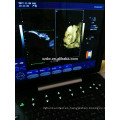 DW-C300 nueva versión portátil 4D color doppler máquina de ultrasonido